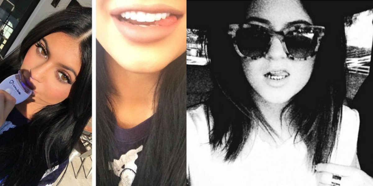 Check Out Kylie Jenner's New Teeth Heat